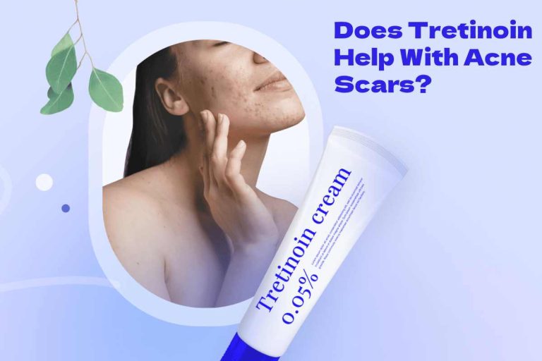 Does Tretinoin Help With Acne Scars?
